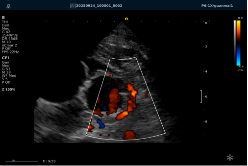 从近期“心源性猝死”高发看健康危机，您的冠脉还好吗？(图16)