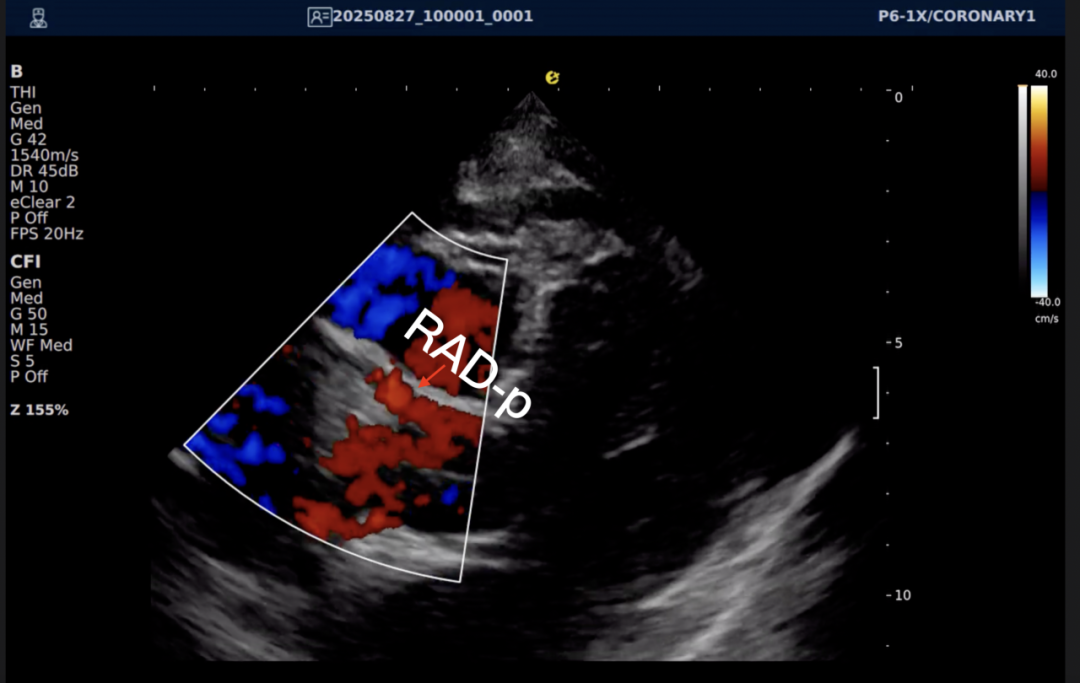 从近期“心源性猝死”高发看健康危机，您的冠脉还好吗？(图24)